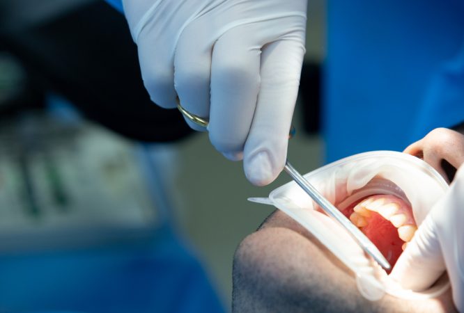 The Latest Dental Restoration Methods in 2025