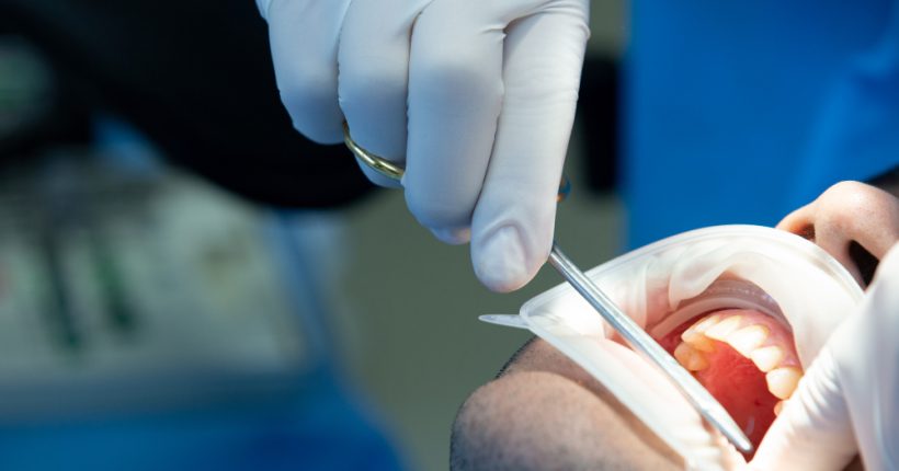 The Latest Dental Restoration Methods in 2025