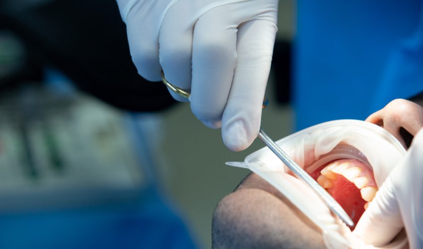 The Latest Dental Restoration Methods in 2025